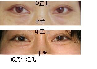 图片15.png 图片15.png